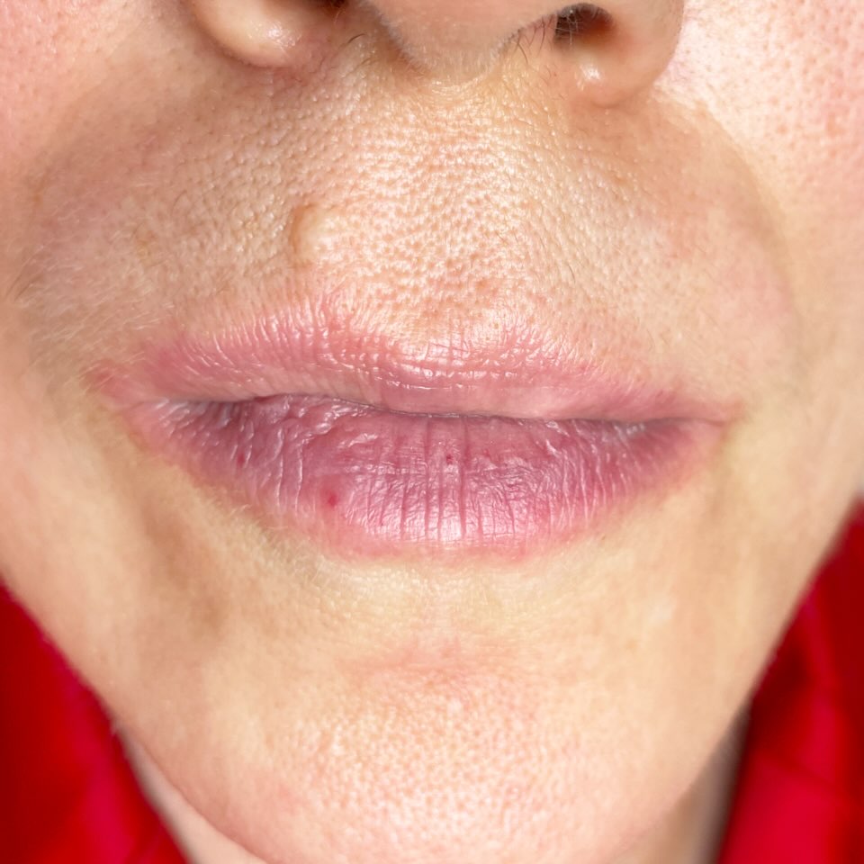 Close-up of lips post-lip tattoo procedure